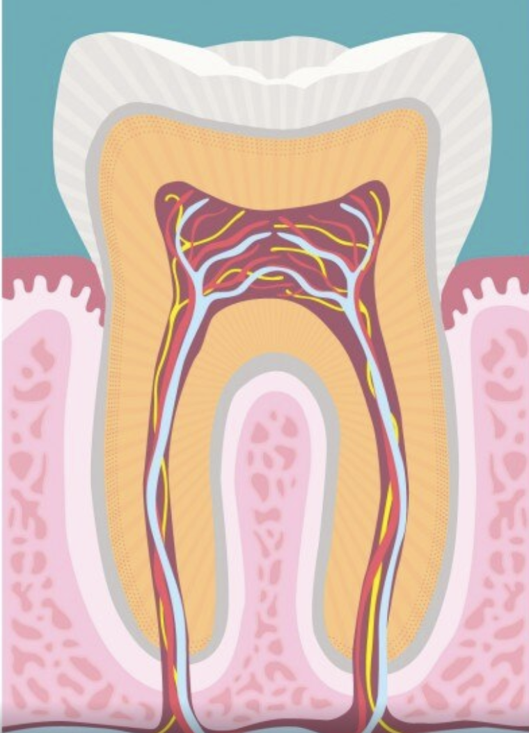 root canal retreatment image