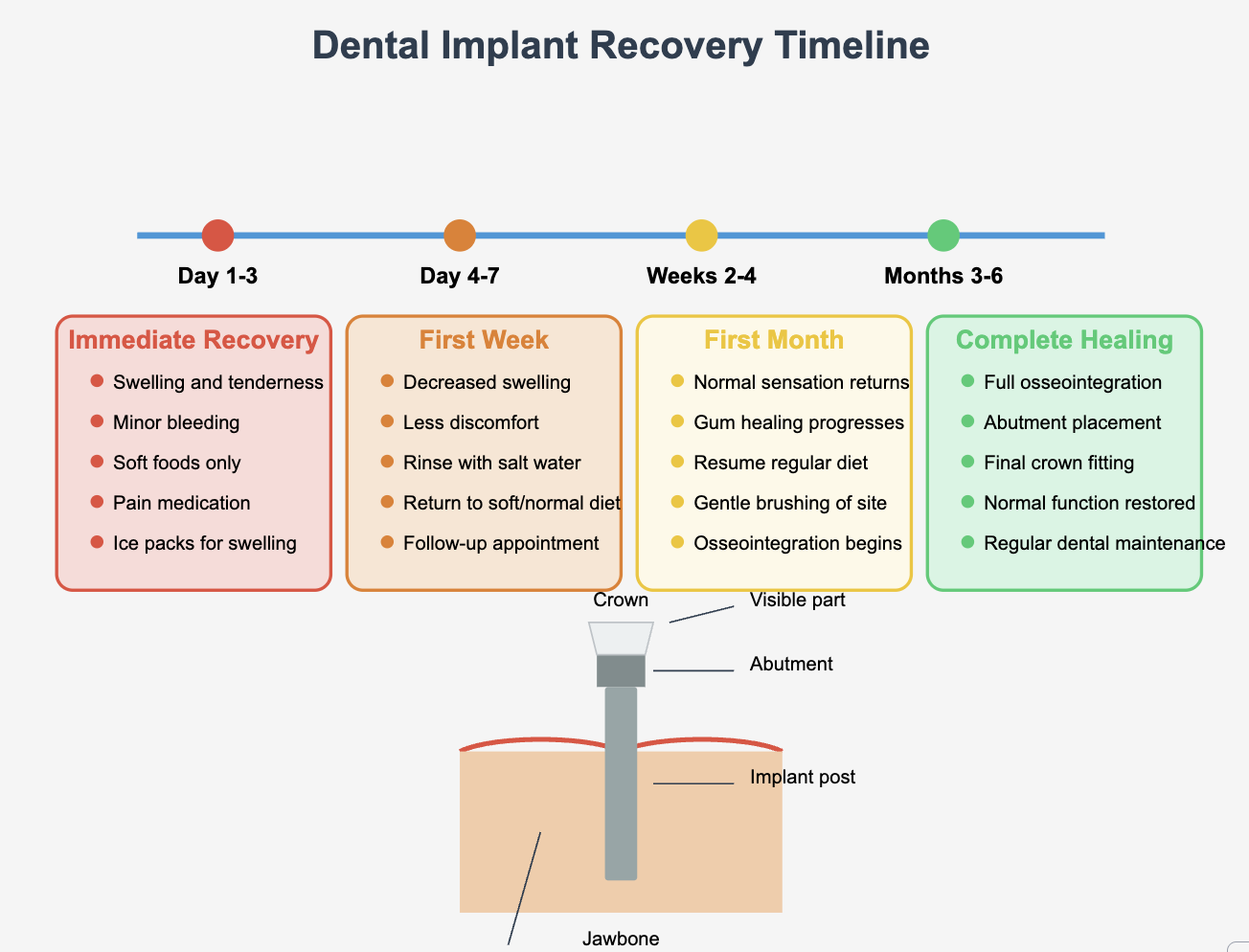 After Implant placement educational guide